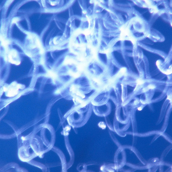 Beneficial nematodes, steinernema-feltiae. Image from PlanetNatural.com #BeneficialNematodes #OrganicPestControl #GoodNematodes #GardenPests